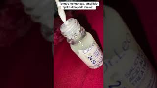 Totol jeriwit FYP totoljerawat drleo drleoacnedryinglotion httpsvttokopediacomtZSjmsVTBV [upl. by Pryce]