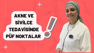 AKNE TEDAVİSİNDE PÜF NOKTALAR  SOYUCU VE ANTİBİYOTİKLİ KREMLERİ KULLANIRKEN DİKKAT EDİLECEKLER [upl. by Eastman]