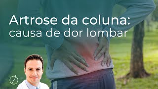 Artrose da coluna ou artrose facetária são causas de dor lombar [upl. by Alacim]