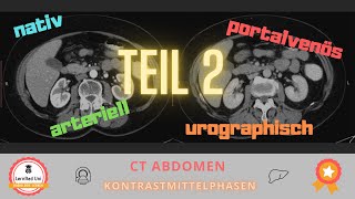 Kontrastmittelphasen in der CT  Teil 2 [upl. by Hennebery996]