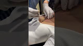 Dermal Piercing at Piercing Zone by Dr Vikas dubai dermalpiercing bodypiercing bellypiercing [upl. by Trant]