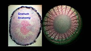 Gnetum Anatomy [upl. by Sheply]