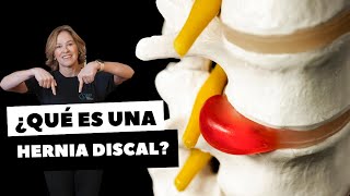 ¿QUÉ ES UNA HERNIA DISCAL [upl. by Florencia]