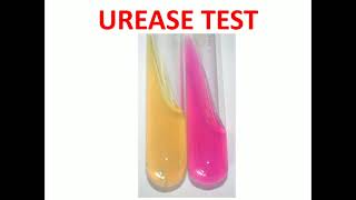 10 Urease Test MLTLectures [upl. by Airolg]