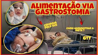 ALIMENTAÇÃO VIA GASTROSTOMIA  Como administrar a dieta pela gtt  CIRURGIA DE GTT PELO SUS [upl. by Yttel]