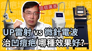 UP雷射 vs 微針電波治療凹痘疤，哪種效果好？皮膚科林政賢醫師點出4大關鍵！ [upl. by Domineca452]