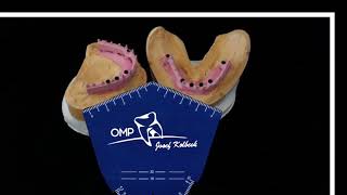 Occlusal Measurement Plane OMP By Jkolbeck CDT  Education [upl. by Jules597]