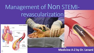 Management of Non STEMI Timing for PCI Anticoagulation antiplatelet UN VS NSTEMI [upl. by Sivram706]