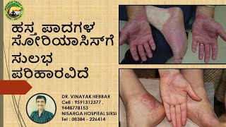 How To Cure Palmoplanter Psoriasis  Home Remedies for Palmoplanter Psoriasis  DR VINAYAK HEBBAR [upl. by Eelytsirk581]