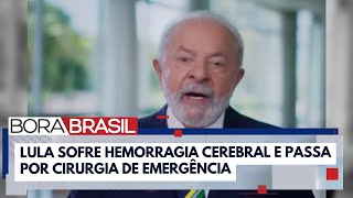 quotPode matarquot As pesquisas dos brasileiros sobre hemorragia cerebral após cirurgia de Lula [upl. by Tollman]