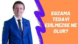 Egzama tedavi edilmezse ne olur [upl. by Irisa]