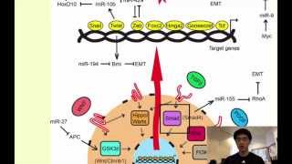 A Novel Form of Cancer Therapy Targeting Metastatic EMT [upl. by Paehpos]