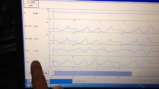 Ford Electronic Throttle Body Failure Diagnosis [upl. by Tarrel56]