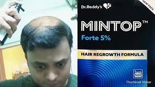 Mintop Forte 5 Minoxidil II Hair Regrowth Formula II Baldness cure II procapil amp Cococin [upl. by Tabatha]