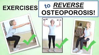 Reversing Osteoporosis Naturally Through Exercise – Best Exercises to Build Bone [upl. by Llerej]