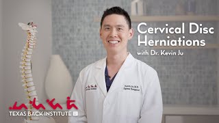 Understanding Cervical Neck Disc Herniations  Dr Kevin Ju  Spine Surgeon  Rockwall TX [upl. by Ivel]