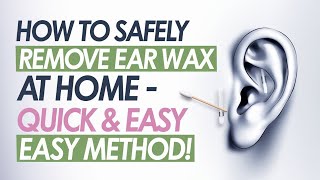 How to Safely Remove Ear Wax at Home – Quick amp Easy Method [upl. by Kanor]