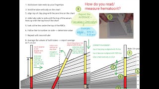 Hematocrit Review [upl. by Jory907]