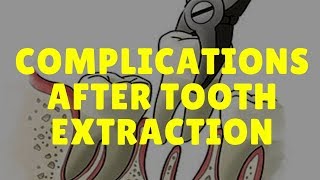 Complications After Tooth Extraction Symptoms amp Treatment Fast Relief [upl. by Eisor]