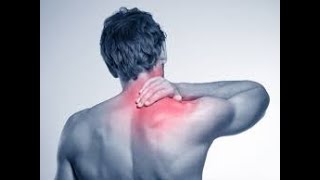 Upper Cross Syndrome  Fix your Posture and Low NeckUpper Back Pain [upl. by Mayhew]