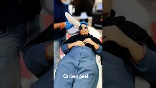 Carban peel treatment minivlog ytshort youtubeshorts manojdayshorts Noorikilife [upl. by Enidualc]