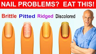 NAIL PROBLEMS  EAT THIS  Dr Mandell [upl. by Richia]