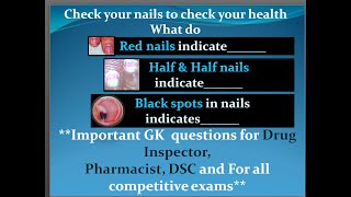 Check your nails to check your healthQuiz13Imp GK for DSC Pharmacist Drug Inspector amp all exams [upl. by Enilegnave]