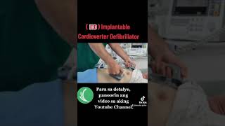 Implantable Cardioverter Defibrillator ICD [upl. by Atiluj]