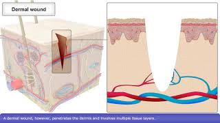 Skin Wound Healing Process [upl. by Bailar]