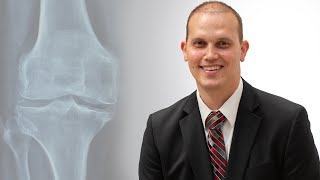 Total Knee Replacement What You Need to Know [upl. by Ebarta]