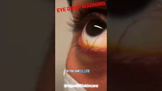 URGENT EYE DROP WARNING  FDA [upl. by Nylehtak356]