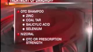 How does work Nizoral 2 Shampoo Anti Dandruff Fungus Hair Loss Treatment Shampoo [upl. by Nobie]