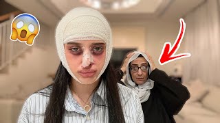 مقلب عملية التجميل بأمي  عصبت وضربتني [upl. by Muffin]