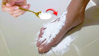 Put baking soda on my feet and you wont believe what happened [upl. by Otiv469]