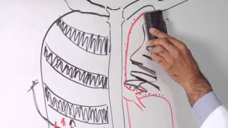 Lobectomy of Lung  Minimally Invasive Approach to Lung Cancer Surgery [upl. by Danny]