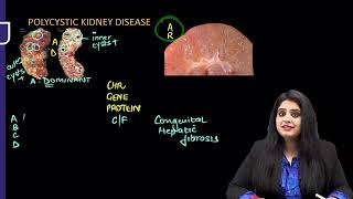 RENAL PATHOLOGY RAPID REVISION FMGEINICET NEET PG [upl. by Krongold]