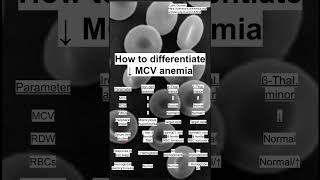 How to differentiate ↓ MCV anemia [upl. by Arrat]