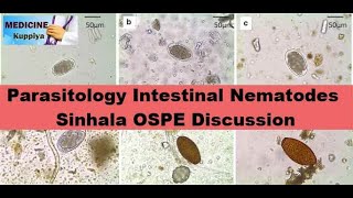 Parasitology Intestinal Nematodes Sinhala OSPE Discussion [upl. by Axela]