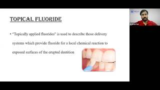 Topical Fluorides Dr Arun Paul E M [upl. by Ecinert205]