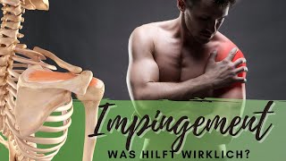 Impingement Syndrom Effektive Übungen bei Schulterschmerzen durch subacromiale Enge  Tests [upl. by Euk759]