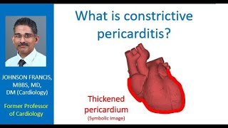 What is constrictive pericarditis [upl. by Nylarat]