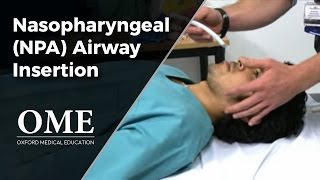 Nasopharyngeal Airway NPA Insertion [upl. by Ardnuhsor]