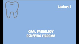 Ossifying Fibroma Complete Lecture  For NBDE NDEB MDS amp FCPS [upl. by Avrom]