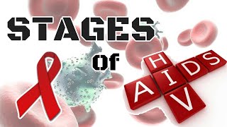 7 SIGNS amp SYMPTOMS OF THE EARLY STAGES OF HIV [upl. by Calabrese]