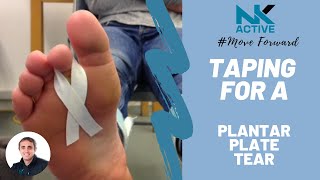 How to tape for a plantar plate tear [upl. by Arrek]