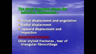 Lecture8ORTHOColles fracture [upl. by Barcus]