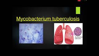 Pathogenesis of pulmonary tuberculosis [upl. by Rabbi]