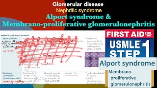 Alport syndrome amp Membranoproliferative glomerulonephritis in HindiUrdu by first aid for step 1 [upl. by Seabrook]