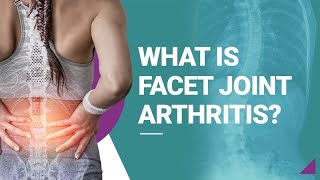 What is Facet Joint Arthritis [upl. by Davies]