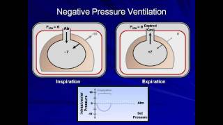 An Introduction to Mechanical Ventilation Mechanical Ventilation  Lecture 1 [upl. by Anitteb]